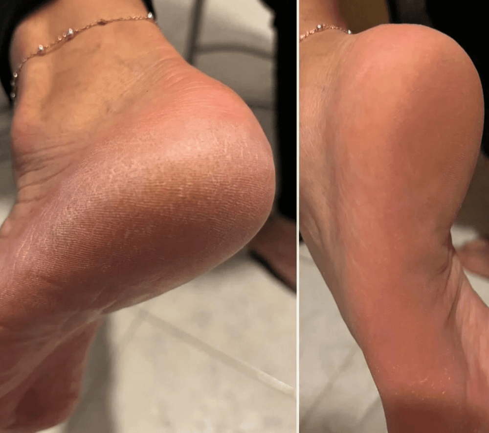 <p>לקוחות ממליצים </p>