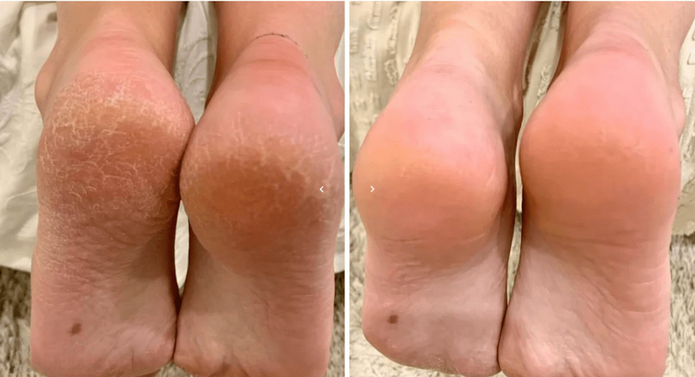 <p>לקוחות ממליצים </p>