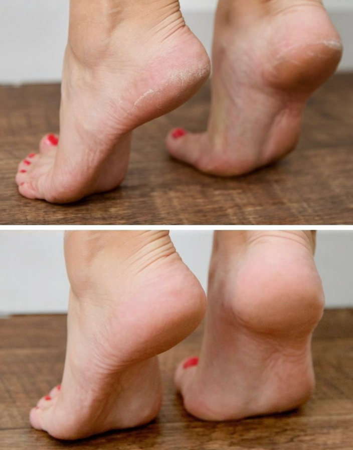 <p>לקוחות ממליצים </p>