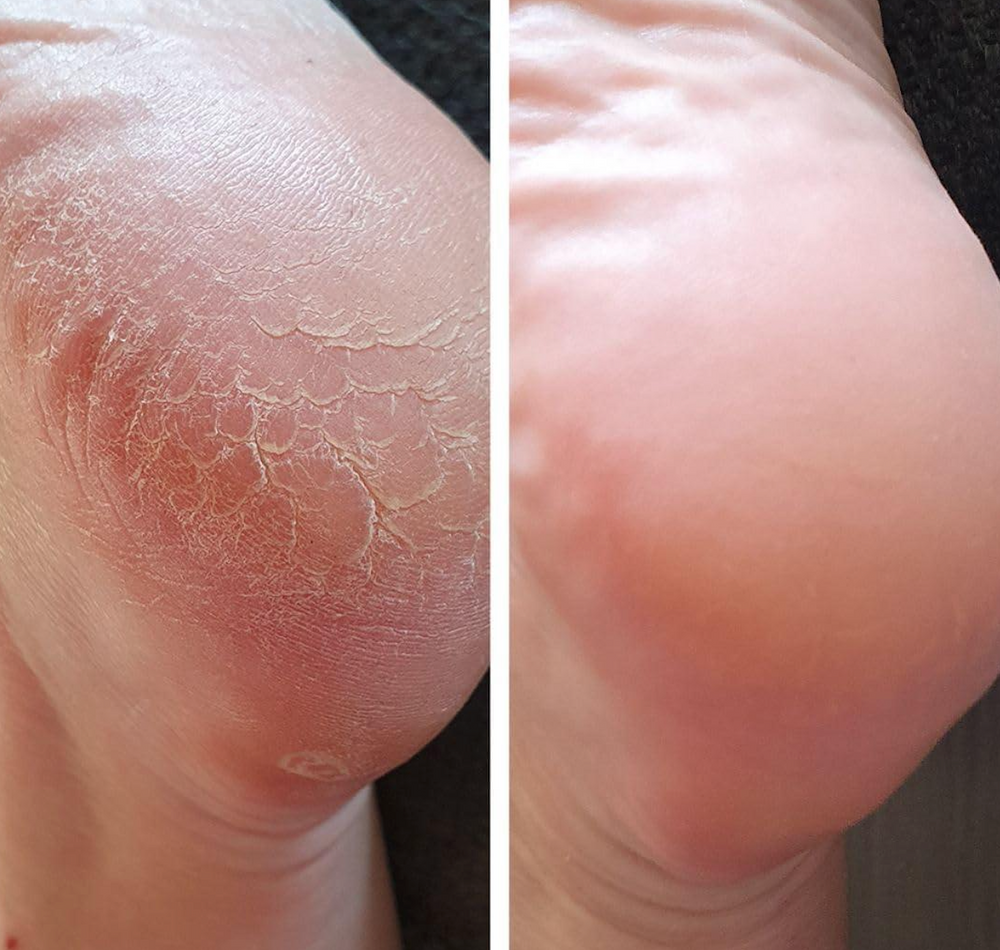 <p>נשות LEVORO משתפות </p>