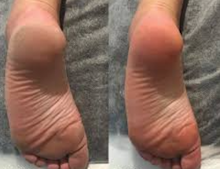 <p>נשות LEVORO משתפות </p>