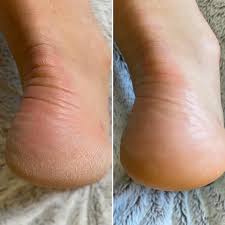 <p>נשות LEVORO משתפות </p>