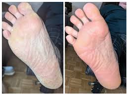 <p>לקוחות ממליצים </p>